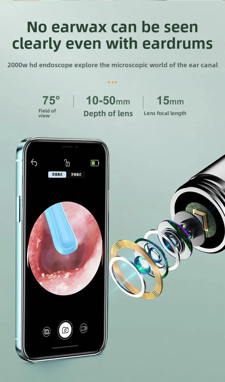 ClearView™ Smart Ear Camera Cleaner – HD Wax Removal Tool (iOS/Android Compatible)