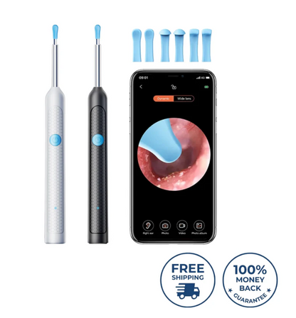ClearView™ Smart Ear Camera Cleaner – HD Wax Removal Tool (iOS/Android Compatible)