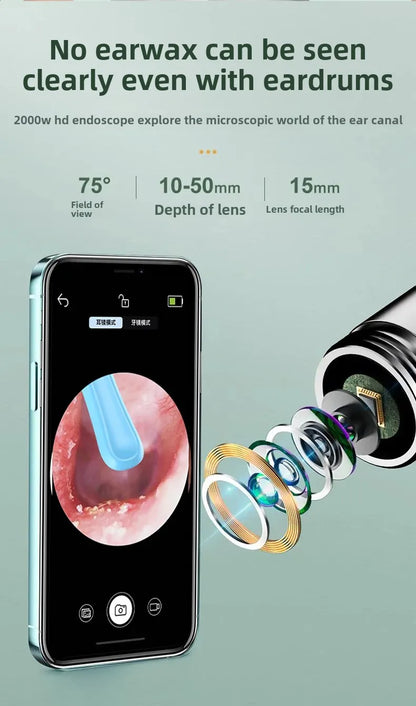 ClearView™ Smart Ear Camera Cleaner – HD Wax Removal Tool (iOS/Android Compatible)